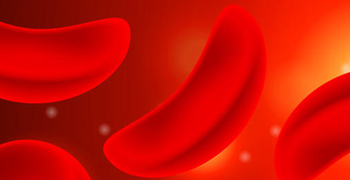 Scientists Try New Approach to Sickle Cell Disease